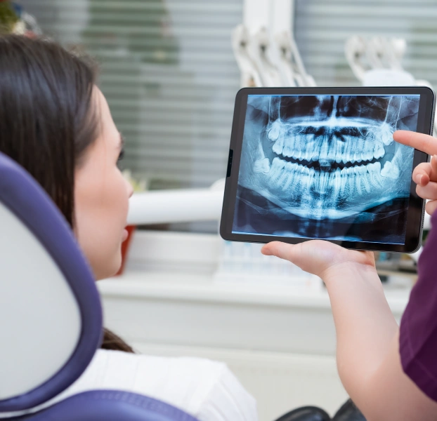 Digital dental X-ray imaging used for accurate diagnosis