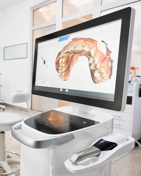 Digital 3D Scanning